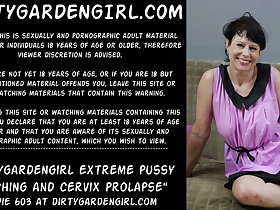 Dirtygardengirl experimental pussy holing coupled with cervix prolapse