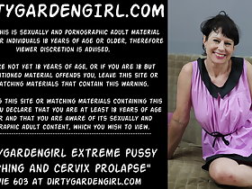 Dirtygardengirl experimental pussy holing coupled with cervix prolapse